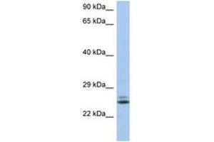 Image no. 1 for anti-RAB15, Member RAS Onocogene Family (RAB15) (AA 35-84) antibody (ABIN6743923) (RAB15 抗体  (AA 35-84))