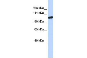 WB Suggested Anti-PIWIL4 Antibody Titration: 0. (PIWIL4 抗体  (N-Term))