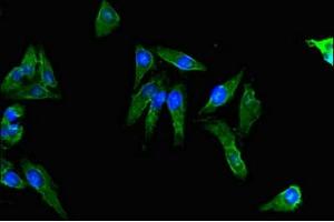 Immunofluorescent analysis of Hela cells using ABIN7143140 at dilution of 1:100 and Alexa Fluor 488-congugated AffiniPure Goat Anti-Rabbit IgG(H+L) (Actin, gamma 1 抗体  (AA 13-166))