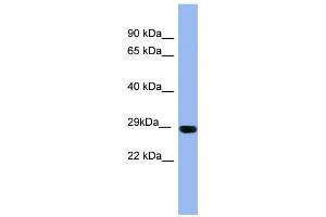 WB Suggested Anti-RAB1A Antibody Titration: 0.