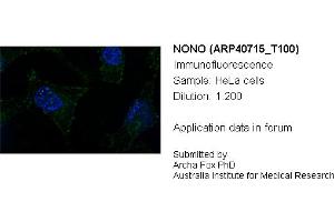 Image no. 2 for anti-Non-POU Domain Containing, Octamer-Binding (NONO) (N-Term) antibody (ABIN2779027) (NONO 抗体  (N-Term))