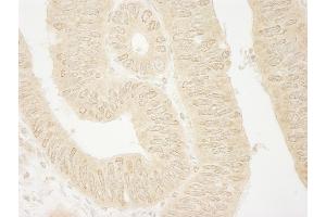 anti-rho Guanine Nucleotide Exchange Factor (GEF) 16 (ARHGEF16) (AA 175-225) antibody