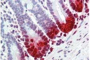 Human Small Intestine (formalin-fixed, paraffin-embedded) stained with DEFA5 antibody ABIN396940 at 10 ug/ml followed by biotinylated anti-mouse IgG secondary antibody ABIN481714, alkaline phosphatase-streptavidin and chromogen. (DEFA5 抗体)