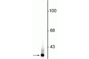 Western blot of rat kidney lysate showing specific immunolabeling of the ~21 kDa Park7 protein. (PARK7/DJ1 抗体)
