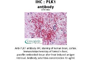 Image no. 1 for anti-Polo-Like Kinase 1 (PLK1) (AA 161-440) antibody (ABIN1738157)