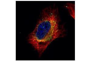 ICC/IF Image Confocal immunofluorescence analysis (Olympus FV10i) of paraformaldehyde-fixed HeLa, using Cofilin 2 (muscle), antibody (Green) at 1:500 dilution. (Cofilin 2 抗体)