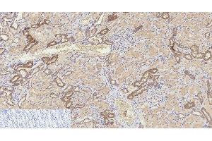 Immunohistochemistry of paraffin-embedded Human kidney tissue using Cleaved-CASP8 (D384) Polyclonal Antibody at dilution of 1:200. (Caspase 8 抗体  (Cleaved-Asp384))