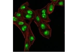Immunofluorescence staining of HeLa cells.