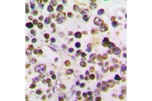Immunohistochemical analysis of Cyclin A1 staining in human testis formalin fixed paraffin embedded tissue section. (Cyclin A1 抗体  (C-Term))