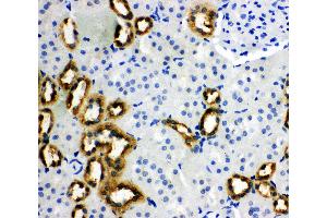 Immunohistochemistry (IHC) image for anti-Phosphatidylethanolamine Binding Protein 1 (PEBP1) (AA 15-29), (N-Term) antibody (ABIN3044276)