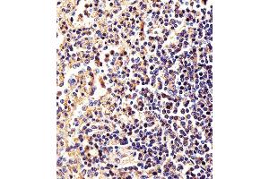 Immunohistochemical analysis of paraffin-embedded H. (beta Actin 抗体)