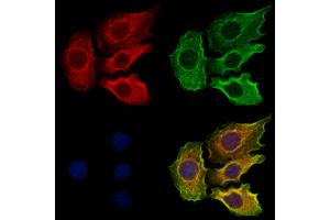 ABIN6265108 and ABIN6273319 staining Hela cells by IF/ICC. (SLC13A2 抗体  (Internal Region))