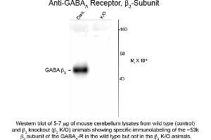 Western Blotting (WB) image for anti-gamma-aminobutyric Acid (GABA) A Receptor, beta 3 (GABRB3) (Cytoplasmic Loop) antibody (ABIN6658225)