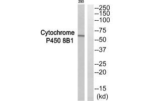 Western blot analysis of extracts from 293 cells, using CYP8B1 antibody. (CYP8B1 抗体  (Internal Region))