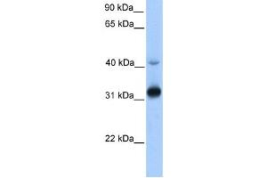 Western Blotting (WB) image for anti-Trans-2,3-Enoyl-CoA Reductase (TECR) antibody (ABIN2459195) (TECR 抗体)