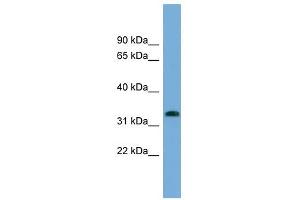 IFI35 antibody used at 1 ug/ml to detect target protein. (IFI35 抗体  (N-Term))