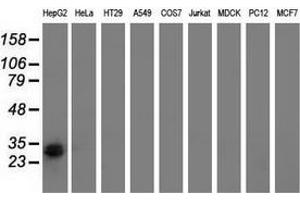 Western blot analysis of extracts (35 µg) from 9 different cell lines by using anti-RASD2 monoclonal antibody. (RASD2 抗体)