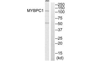 Western Blotting (WB) image for anti-Myosin Binding Protein C, Slow Type (MYBPC1) (Internal Region) antibody (ABIN1851619) (MYBPC1 抗体  (Internal Region))