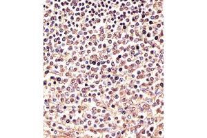 Immunohistochemistry (Paraffin-embedded Sections) (IHC (p)) image for anti-Proteasome (Prosome, Macropain) Subunit, beta Type, 9 (Large Multifunctional Peptidase 2) (PSMB9) (AA 205-239), (C-Term) antibody (ABIN6243739)