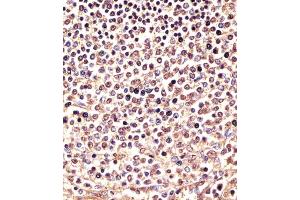 (ABIN6243739 and ABIN6577971) staining PSMB9 in human spleen sections by Immunohistochemistry (IHC-P - paraformaldehyde-fixed, paraffin-embedded sections). (PSMB9 抗体  (C-Term))