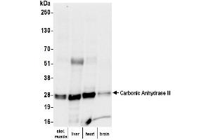 Western Blotting (WB) image for anti-Carbonic Anhydrase III (CA3) antibody (ABIN7795613)