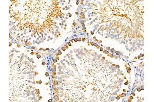 ABIN6256941 and ABIN6274588 at 1/100 staining Rat testis tissue by IHC-P. (beta Arrestin 1 抗体  (C-Term))