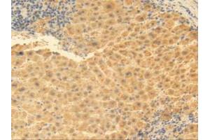 IHC-P analysis of Human Liver Tissue, with DAB staining. (MGP 抗体  (AA 1-103))