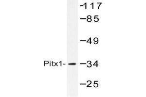 Western blot (WB) analysis of Pitx1 antibody in extracts from Jurkat cells. (PITX1 抗体)