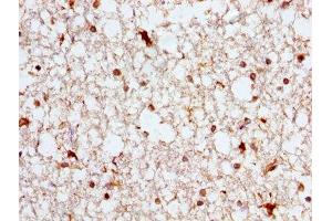 IHC image of ABIN7144757 diluted at 1:300 and staining in paraffin-embedded human brain tissue performed on a Leica BondTM system. (Aspartate beta Hydroxylase 抗体  (AA 75-270))