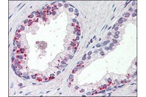 Human Prostate (formalin-fixed, paraffin-embedded) stained with ANXA1at 4 µg/ml followed by biotinylated anti-goat IgG secondary antibody, alkaline phosphatase-streptavidin and chromogen. (Annexin a1 抗体  (C-Term))