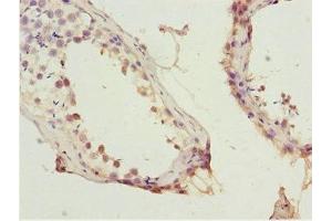 Immunohistochemistry of paraffin-embedded human testis tissue using ABIN7156130 at dilution of 1:100 (KPNA5 抗体  (AA 1-240))