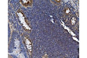 IHC analysis of SEC14L3/TAP2 using anti-SEC14L3/TAP2 antibody (ABIN7601623).