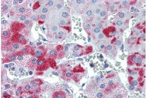 Human Adrenal (formalin-fixed, paraffin-embedded) stained with M6PRBP1 antibody ABIN351437 at 5 ug/ml followed by biotinylated goat anti-rabbit IgG secondary antibody ABIN481713, alkaline phosphatase-streptavidin and chromogen. (PLIN3 抗体  (N-Term))