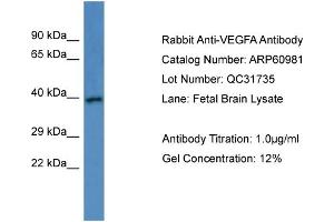 Western Blotting (WB) image for anti-Vascular Endothelial Growth Factor A (VEGFA) (C-Term) antibody (ABIN2788641) (VEGFA 抗体  (C-Term))