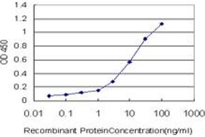 Detection limit for recombinant GST tagged RORB is approximately 0. (RORB 抗体  (AA 136-224))