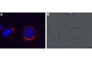 Expression of MC4R in rat pituitary cell line - Cell surface detection of MC4R in live intact GH3 cells with Anti-MC4 Receptor (extracellular) Antibody (ABIN7043324, ABIN7044596 and ABIN7044597), (1:50). (MC4R 抗体  (Extracellular, N-Term))