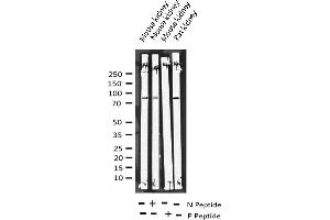 Western blot analysis of Phospho-Tau (Ser422) expression in various lysates (MAPT 抗体  (pSer422))