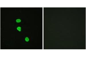 Immunofluorescence analysis of HeLa cells, using AS160 (Phospho-Thr642) Antibody. (TBC1D4 抗体  (pThr642))