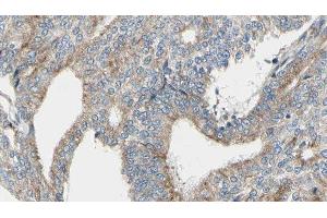 ABIN6276352 at 1/100 staining Human prostate tissue by IHC-P. (TUBA4A 抗体  (N-Term))