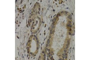 Immunohistochemistry (IHC) image for anti-Melanoma Antigen Family A, 1 (Directs Expression of Antigen MZ2-E) (MAGEA1) (AA 1-309) antibody (ABIN6143435)
