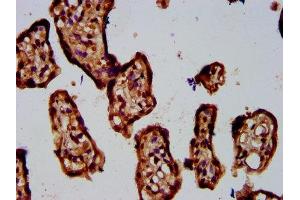 IHC image of ABIN7142890 diluted at 1:400 and staining in paraffin-embedded human placenta tissue performed on a Leica BondTM system. (ADAMTS5 抗体  (AA 535-646))