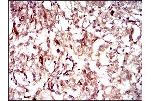 Immunohistochemistry (IHC) image for anti-Guanylate Cyclase 1 Soluble Subunit Alpha (GUCY1A1) (AA 22-214) antibody (ABIN1724787)