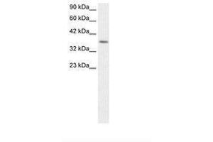Image no. 1 for anti-Ribosomal Protein S16 (RPS16) (AA 92-139) antibody (ABIN202390) (RPS16 抗体  (AA 92-139))