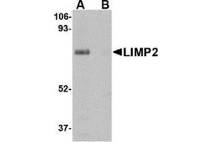 Western Blotting (WB) image for anti-Scavenger Receptor Class B, Member 2 (SCARB2) (Middle Region) antibody (ABIN1030987) (SCARB2 抗体  (Middle Region))