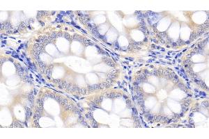 Detection of IL10 in Canine Colon Tissue using Polyclonal Antibody to Interleukin 10 (IL10) (IL-10 抗体  (AA 21-181))