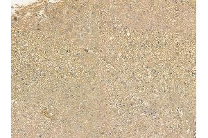 ABIN6256326 and ABIN6267207 at 1/100 staining human normal liver tissue by IHC-P. (WIPI2 抗体  (pSer413))