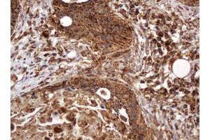 Image no. 11 for anti-B and T Lymphocyte Associated (BTLA) antibody (ABIN1496983)