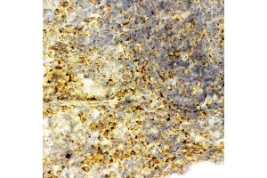 Anti-Caspase-6(P18) antibody, IHC(F): Rat Spleen Tissue (Caspase 6 抗体  (N-Term))