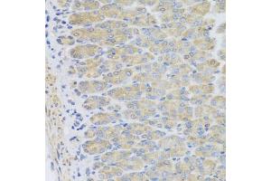 Immunohistochemistry of paraffin-embedded mouse stomach using EFHC1 antibody (ABIN5975244) at dilution of 1/100 (40x lens). (EFHC1 抗体)
