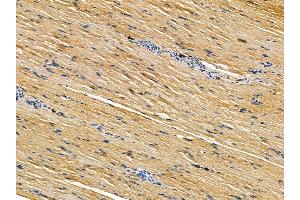 ABIN7095493 and ABIN7099550 at 1/100 staining rat muscle tissue by IHC-P.